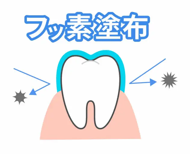 フッ素洗口